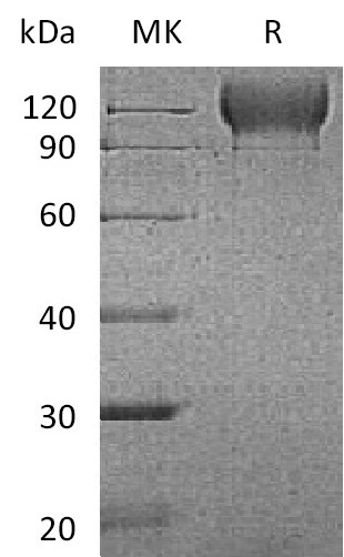 Biotinylated Mouse P-selectin +SDS-PAGE.jpg